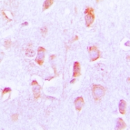 CPA1095-100ul - Bcl-2