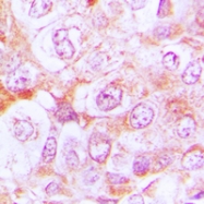 CPA1117-100ul - Complement C6