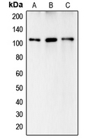 CPA1117-100ul - Complement C6