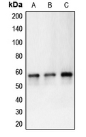 CPA1123-100ul - Carbonic anhydrase 9