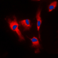 CPA1126-100ul - Calmodulin