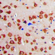 CPA1126-100ul - Calmodulin