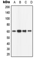 CPA1127-100ul - CAMK2B