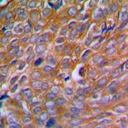 CPA1129-100ul - Calnexin
