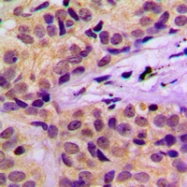 CPA1164-100ul - CBL / RNF55