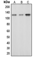 CPA1164-100ul - CBL / RNF55