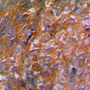 CPA1165-100ul - CBL / RNF55