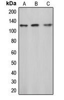 CPA1165-100ul - CBL / RNF55