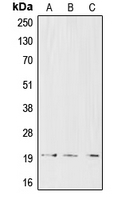 CPA1177-100ul - CD3 delta chain