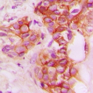 CPA1185-100ul - CD40