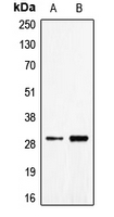 CPA1188-100ul - CD70