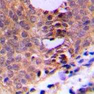 CPA1189-100ul - CDK1