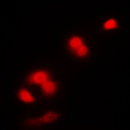 CPA1190-100ul - CDK1