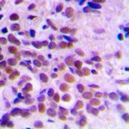 CPA1190-100ul - CDK1