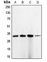 CPA1190-100ul - CDK1