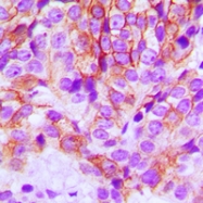 CPA1198-100ul - CD324 / Cadherin-1