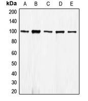 CPA1198-100ul - CD324 / Cadherin-1
