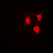 CPA1205-100ul - CDK2