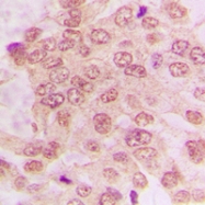 CPA1205-100ul - CDK2