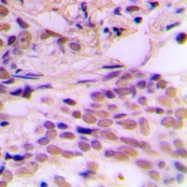 CPA1206-100ul - CDK7