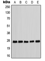 CPA1208-100ul - CDKN1B / KIP1