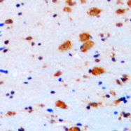 CPA1209-100ul - CDKN1B / KIP1