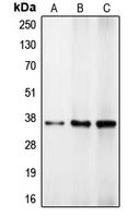 CPA1216-100ul - CEBPB