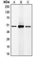 CPA1217-100ul - CEBPB