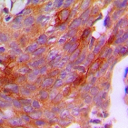 CPA1220-100ul - Chorionic Gonadotropin (hCG)