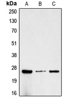 CPA1220-100ul - Chorionic Gonadotropin (hCG)