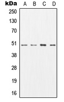 CPA1239-100ul - AP2 complex subunit mu-1 / AP2M1