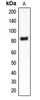 CPA1240-100ul - CLCN4