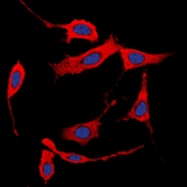 CPA1250-100ul - Collagen type I alpha 2 chain