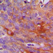 CPA1250-100ul - Collagen type I alpha 2 chain