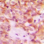 CPA1251-100ul - Collagen type I alpha 2 chain