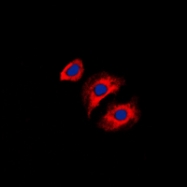 CPA1252-100ul - Collagen type III alpha 1 chain