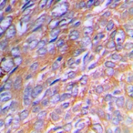 CPA1252-100ul - Collagen type III alpha 1 chain