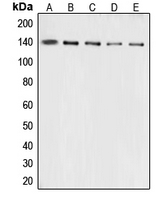 CPA1252-100ul - Collagen type III alpha 1 chain