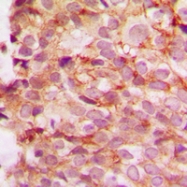 CPA1254-100ul - Collagen type IV
