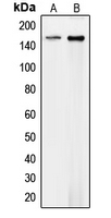 CPA1254-100ul - Collagen type IV