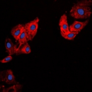 CPA1255-100ul - Collagen type V