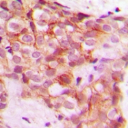 CPA1255-100ul - Collagen type V