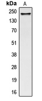 CPA1255-100ul - Collagen type V