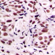 CPA1268-100ul - CREB1