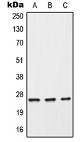 CPA1275-100ul - C-reactive protein (CRP)