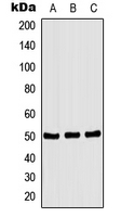 CPA1279-100ul - CSK