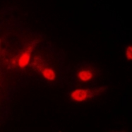 CPA1282-100ul - Casein kinase I epsilon