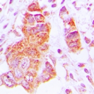 CPA1282-100ul - Casein kinase I epsilon