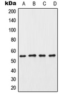 CPA1284-100ul - CSNK1G3