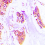 CPA1291-100ul - Cardiotrophin-1